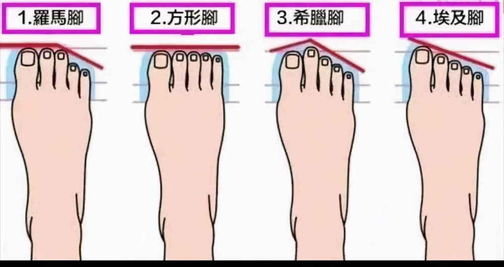 罗马脚,方形脚:不适合尖头高跟鞋,适合圆头和方头希腊脚:第二脚趾长过