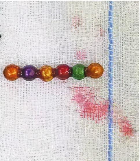 “网红”玩具要慎买，幼童吞11颗巴克球致肠穿孔！这类玩具要远离休闲区蓝鸢梦想 - Www.slyday.coM