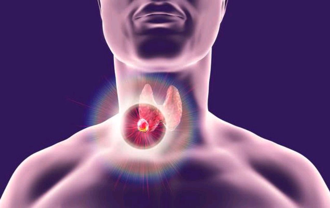 甲状腺不好的人:除了食盐,平时还要少吃2种调味料|蒲公英|甲状腺