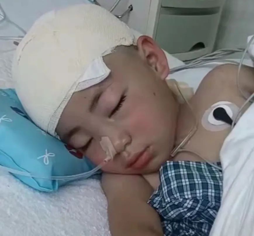 【社会】固原4岁小女孩患上罕见重症,开颅手术后不会说话,不会走路