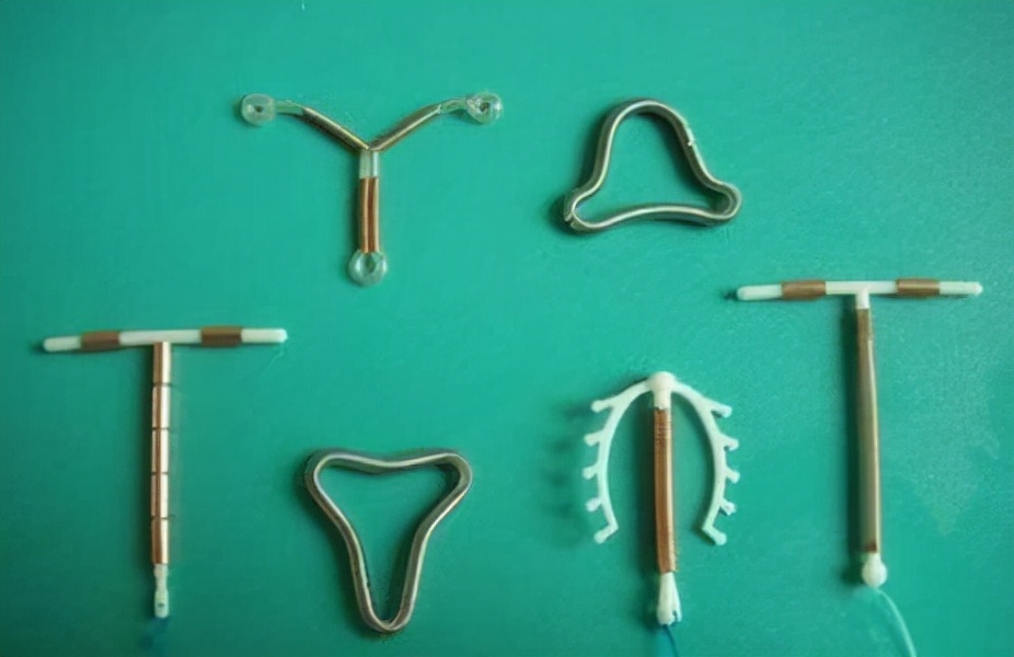 国内首批放置节育环的女性,如今过得怎么样了?大多数不是很乐观