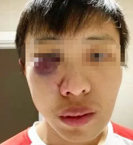 恶劣事件！数名中国留学生在英遇袭休闲区蓝鸢梦想 - Www.slyday.coM