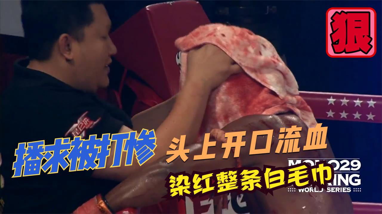 这是播求被打得最狼狈的一场比赛,头部挂彩流血,染红整条白毛巾