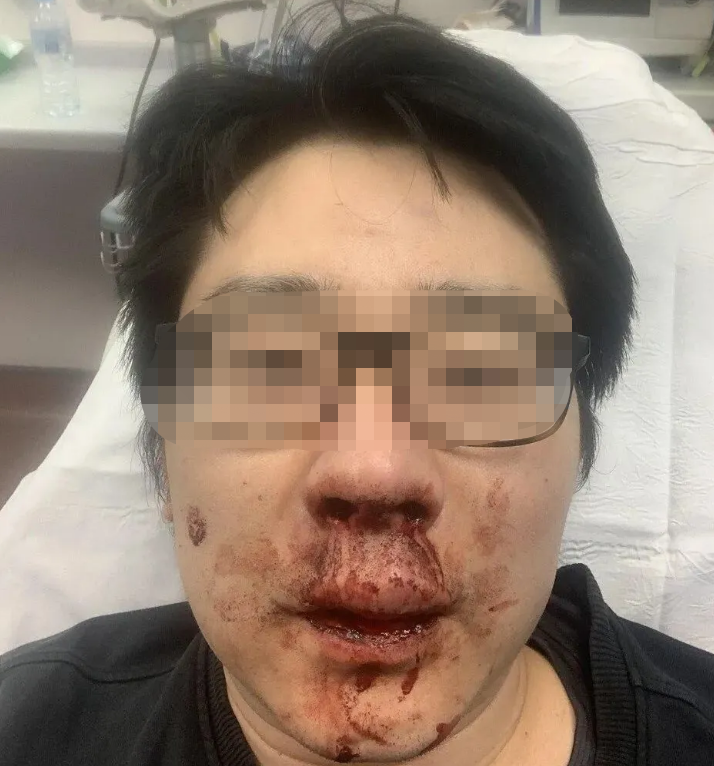 恶劣事件！数名中国留学生在英遇袭休闲区蓝鸢梦想 - Www.slyday.coM