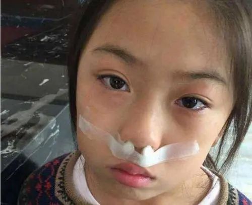 20年老鼻炎有救了用它一抹止痒通气鼻子舒畅又干净