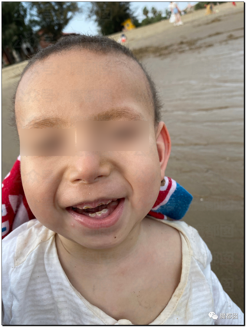 泪目！高中学历父亲为救极罕见病孩子，冒险自制药，最新回应……休闲区蓝鸢梦想 - Www.slyday.coM