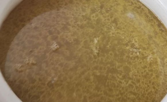 鹿茸菇炖个乡村小母鸡,您是不是把不该丢的丢弃了休闲区蓝鸢梦想 - Www.slyday.coM 鹿茸菇炖个乡村小母鸡,您是不是把不该丢的丢弃了休闲区蓝鸢梦想 - Www.slyday.coM