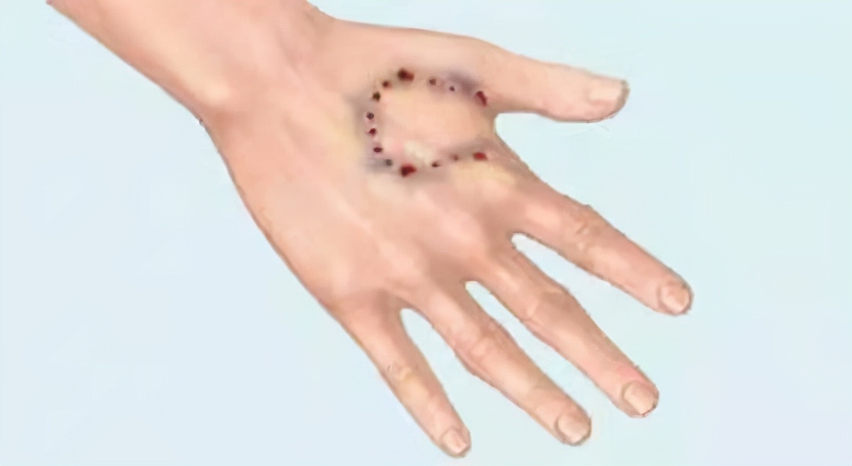 狂犬病病死率几乎100%,医生告诉你:被咬后的预防方法休闲区蓝鸢梦想 - Www.slyday.coM 狂犬病病死率几乎100%,医生告诉你:被咬后的预防方法休闲区蓝鸢梦想 - Www.slyday.coM