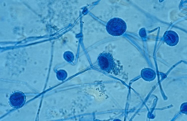 僵尸蚂蚁已经出现这种寄生真菌会给人类带来生化危机吗