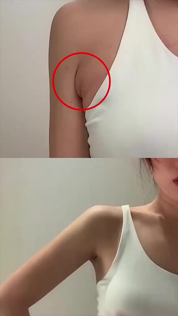 跟我做三个动作,快速消除副乳,胳膊下的肉肉没有了