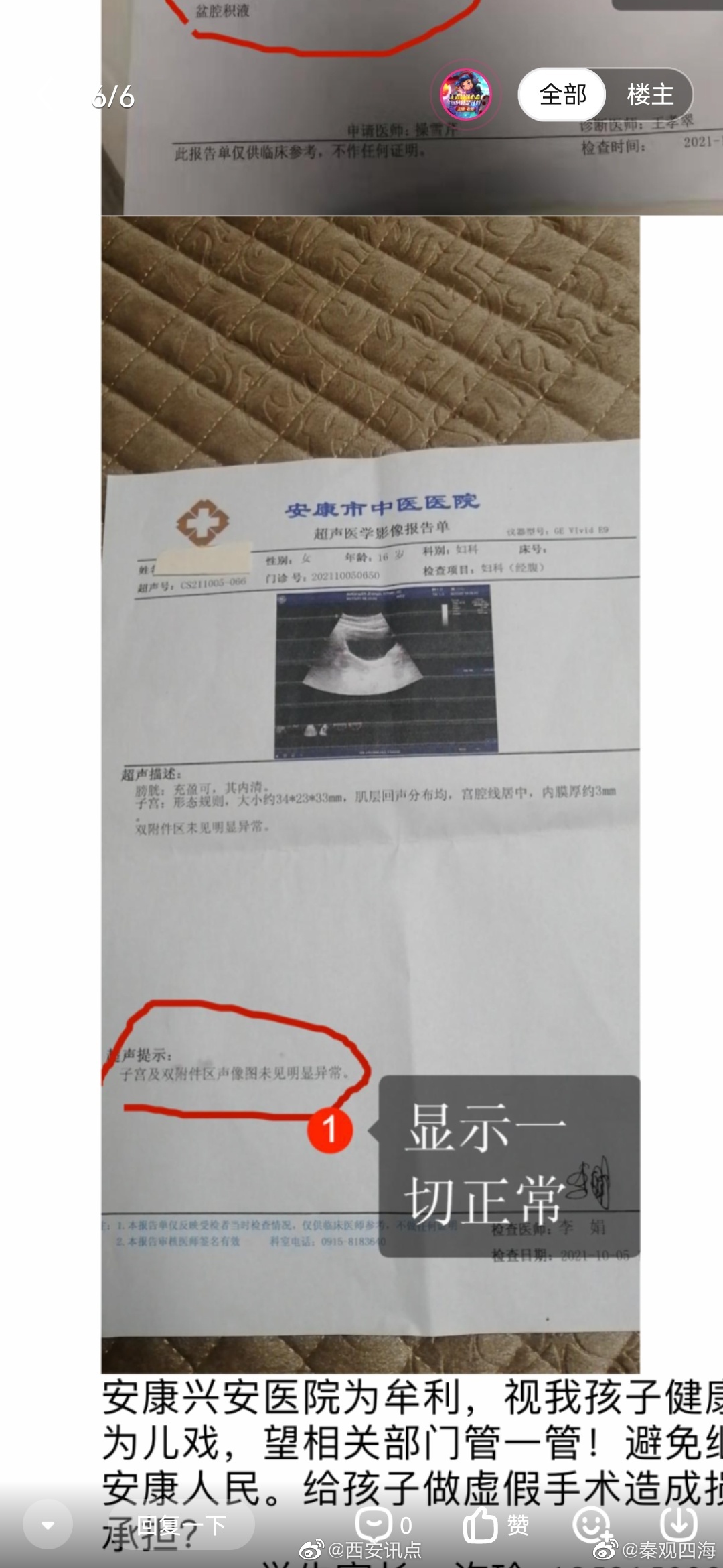 无病女学生被推上手术台,手术中途让打电话借钱,安康这家民营医院丧尽天良休闲区蓝鸢梦想 - Www.slyday.coM 无病女学生被推上手术台,手术中途让打电话借钱,安康这家民营医院丧尽天良休闲区蓝鸢梦想 - Www.slyday.coM