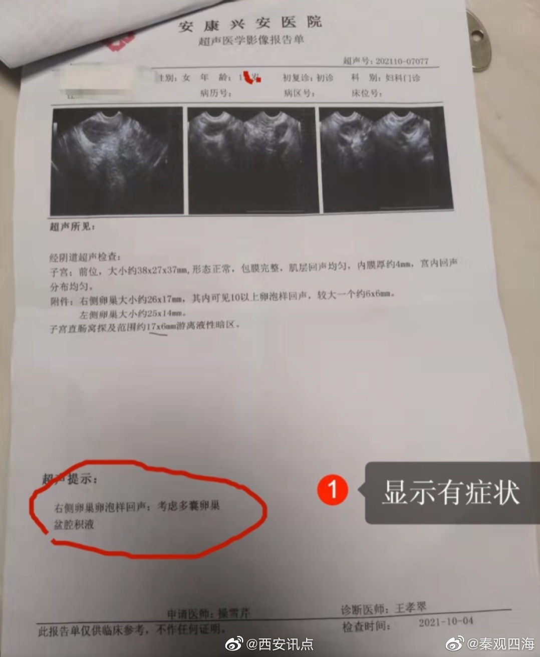 无病女学生被推上手术台,手术中途让打电话借钱,安康这家民营医院丧尽天良休闲区蓝鸢梦想 - Www.slyday.coM 无病女学生被推上手术台,手术中途让打电话借钱,安康这家民营医院丧尽天良休闲区蓝鸢梦想 - Www.slyday.coM