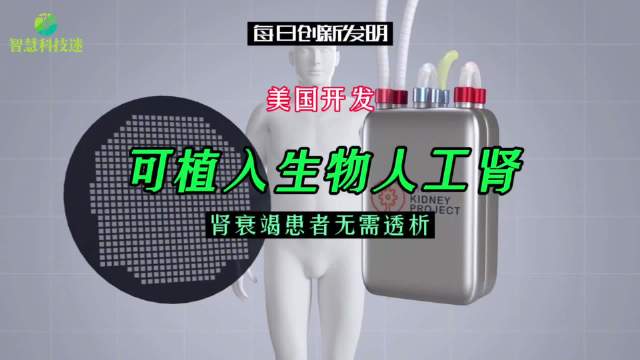 美开发可植入生物人工肾,肾衰竭患者无需透析