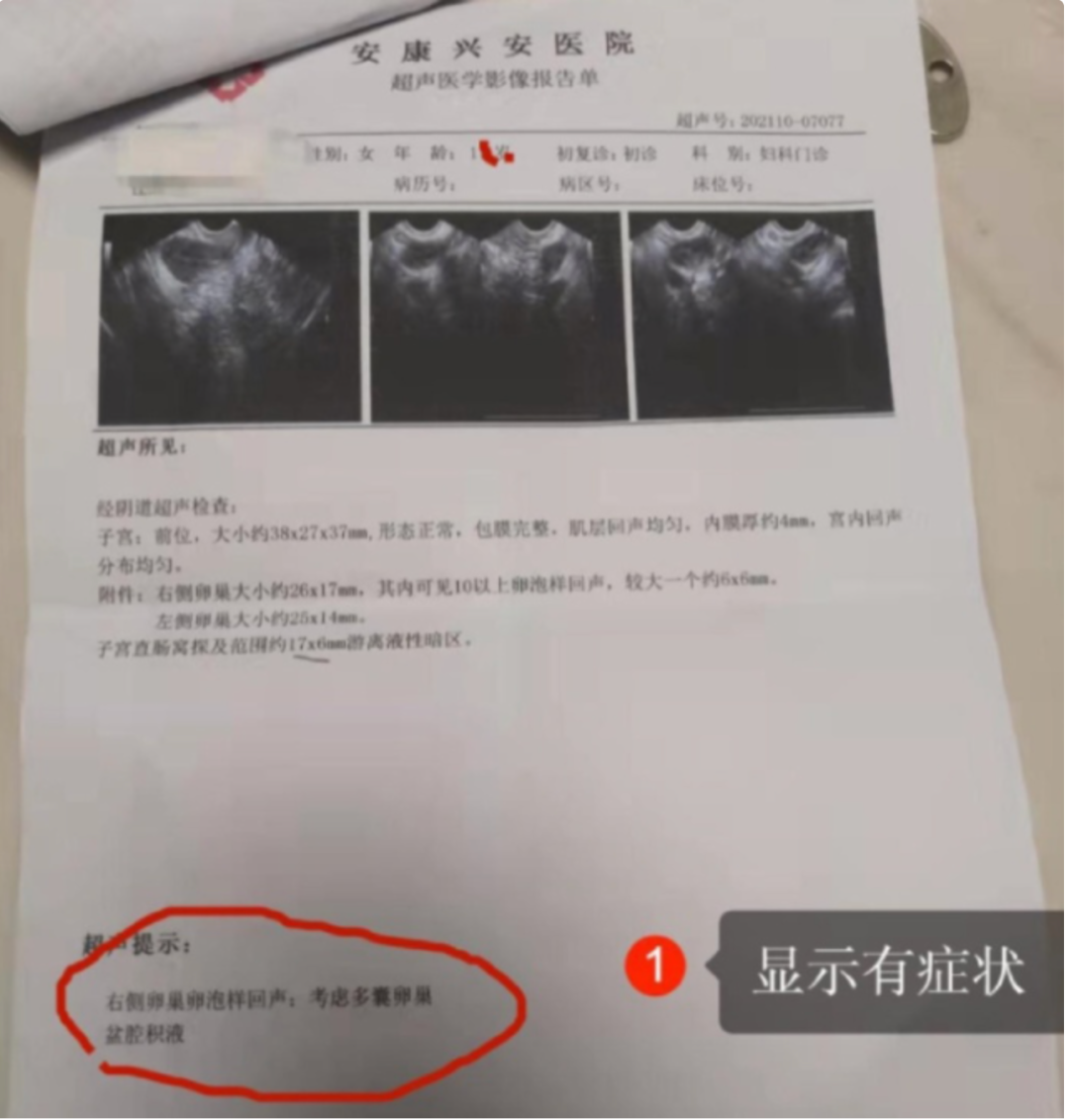 病理检查报告单怎么看图片