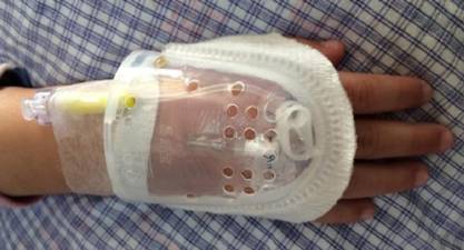 留置针不可使用卷绷带固定这里有答案