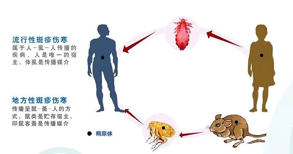 斑疹伤寒(图片源于网络,如有侵权请联系删除)