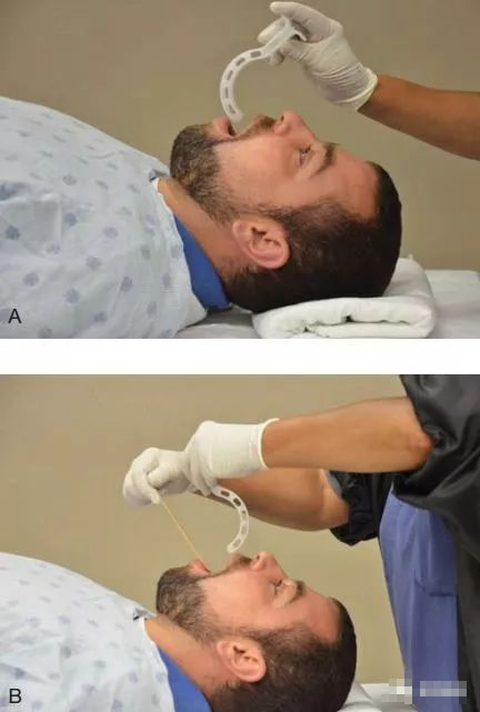 口咽通气道的使用