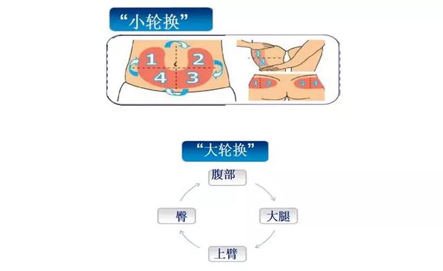 糖尿病治疗共照个案:胰岛素注射技巧及操作方法__财经头条