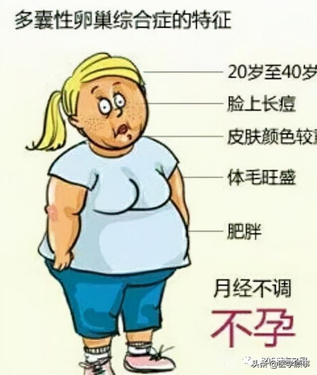 俊俏!多囊卵巢综合症怀孕难吗"激动不已"-第2张图片-追风博客