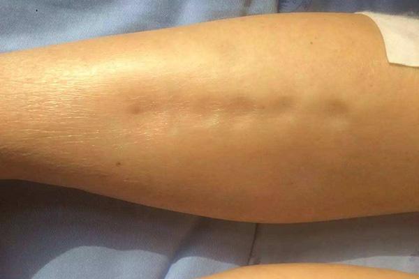 肝病一发现就是晚期？双腿不断释放的“预警信号”，都被人无视了休闲区蓝鸢梦想 - Www.slyday.coM