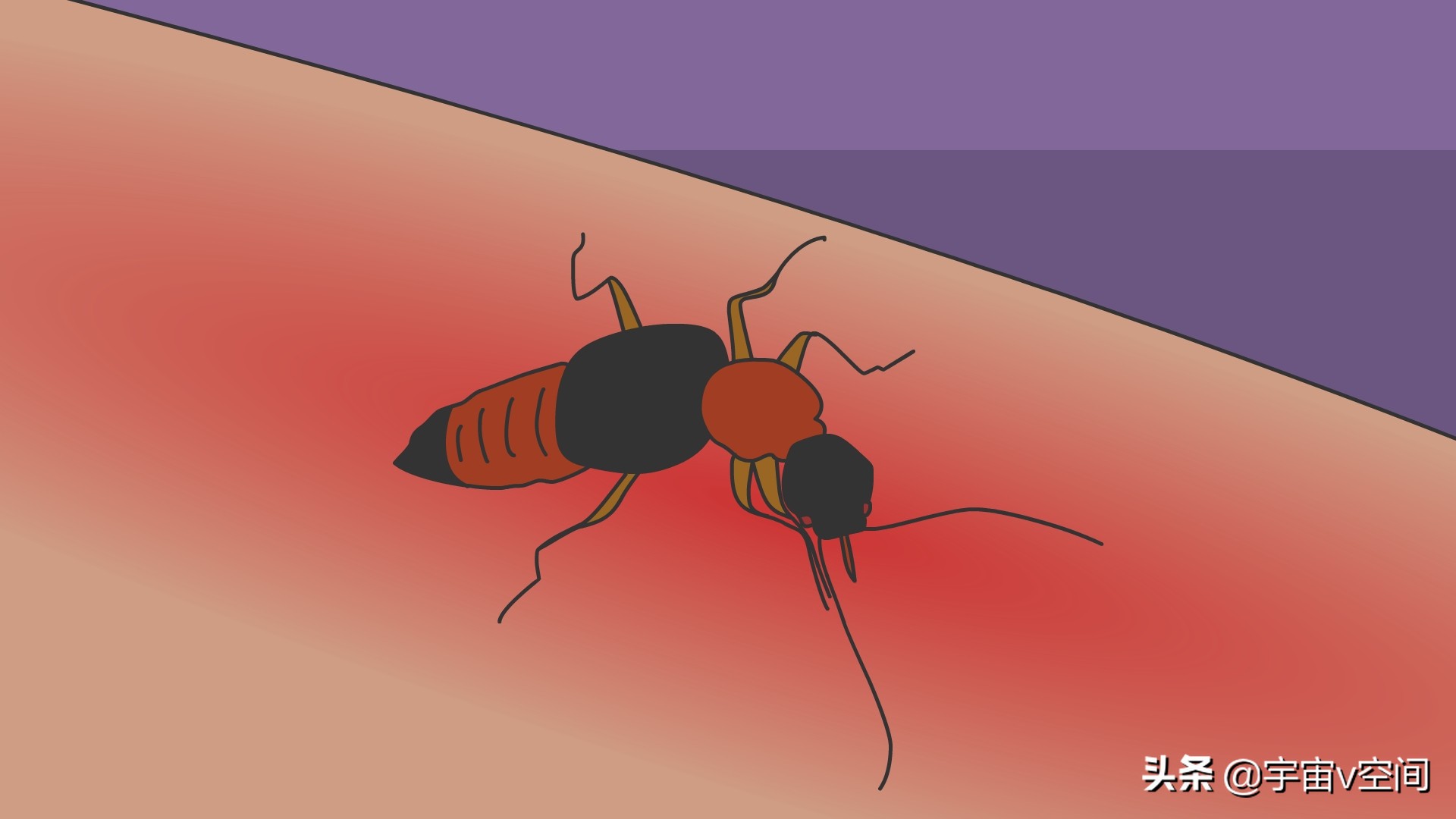 这种虫子爬在身上，再急也不要随手拍死，不然后果很严重休闲区蓝鸢梦想 - Www.slyday.coM