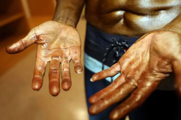 41岁癌症晚期，这个杭州男人却在半年内减脂31斤，站上健美赛场！休闲区蓝鸢梦想 - Www.slyday.coM