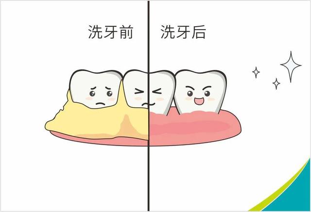 这么大的牙结石你见过吗