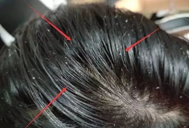 头发软榻出油怎么办?免洗喷雾,一喷一揉瞬间干爽蓬松!