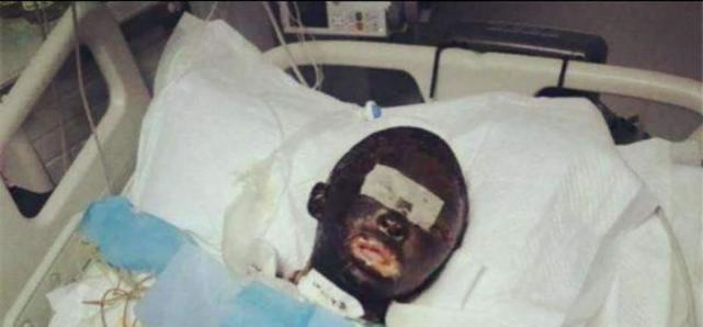 网红拉姆被前夫泼汽油烧伤不治身亡,一审结果宣判,网友拍手叫好休闲区蓝鸢梦想 - Www.slyday.coM 网红拉姆被前夫泼汽油烧伤不治身亡,一审结果宣判,网友拍手叫好休闲区蓝鸢梦想 - Www.slyday.coM