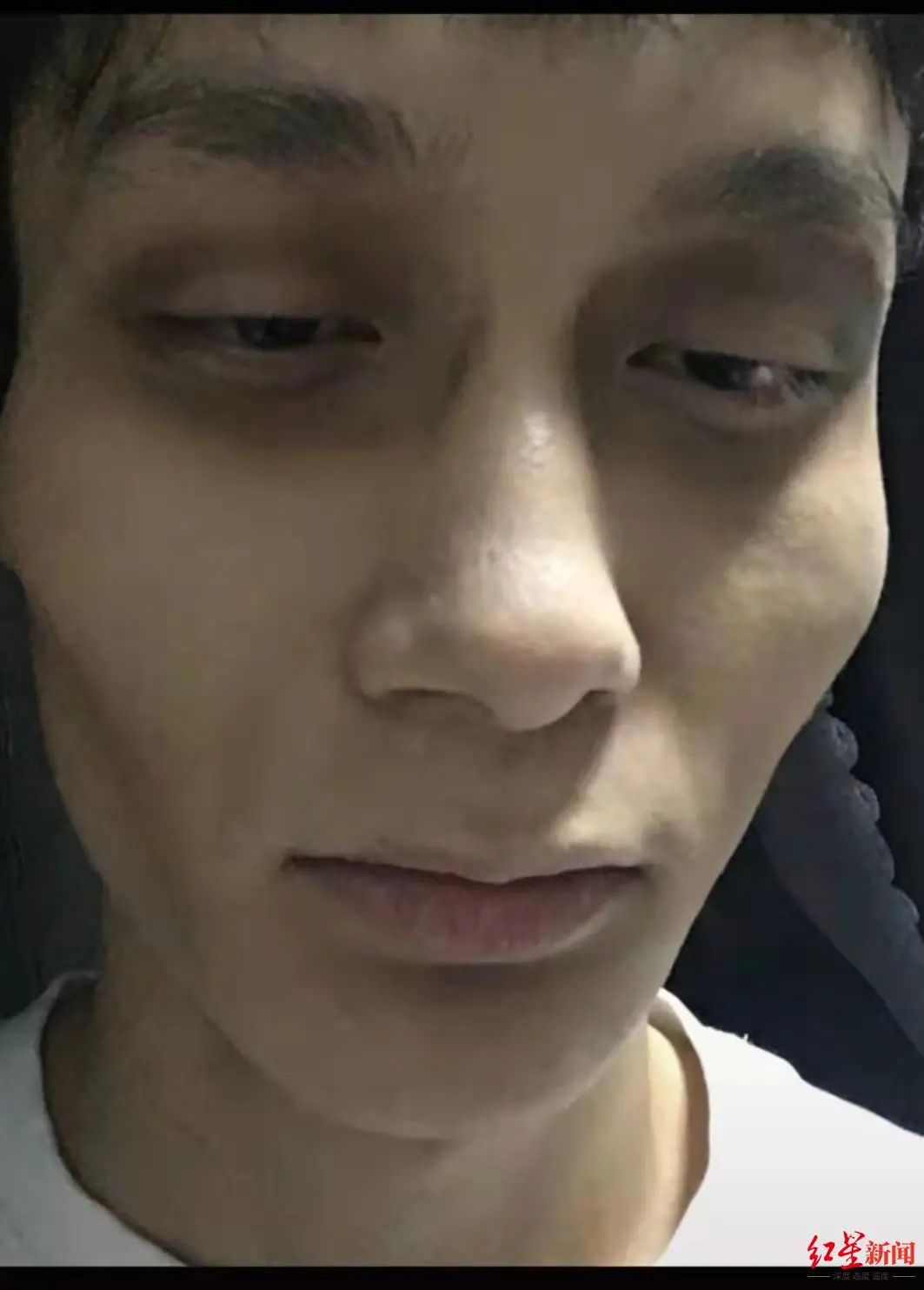 男大学生化虚弱妆走红却被网友举报惊动警方