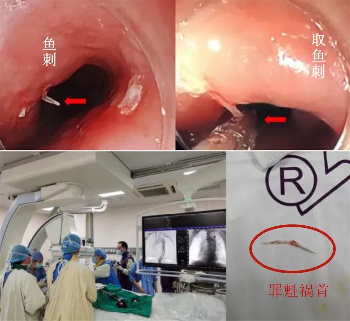 六旬老太吃了口鱼，差点血管破裂！这个危险行为劝你不要做！休闲区蓝鸢梦想 - Www.slyday.coM