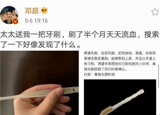 戚薇门牙怎么了 戚薇门牙劈了磕掉了一小块是怎么受伤的