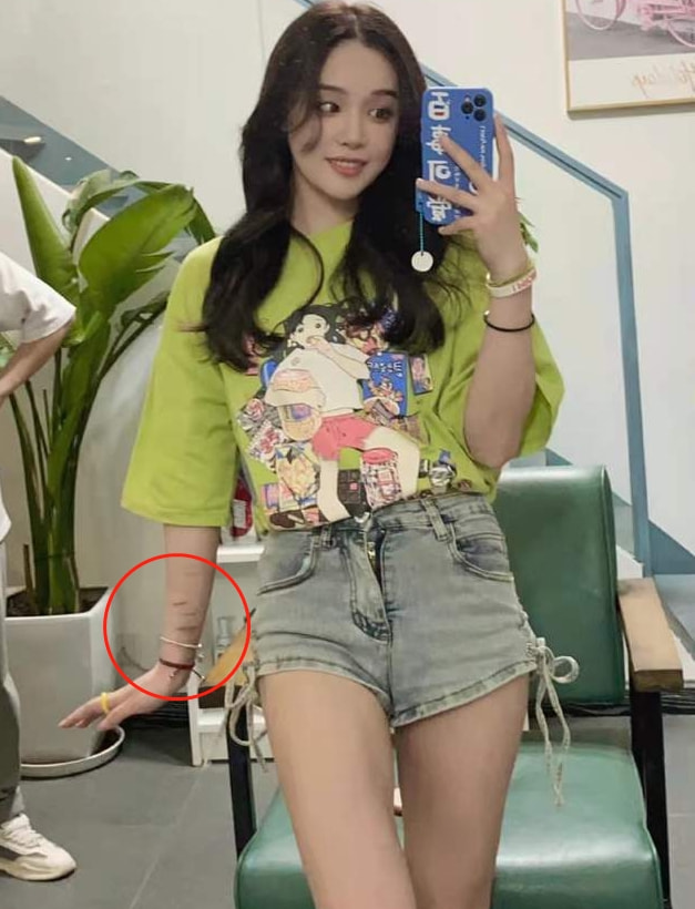 网红患抑郁症直播喝农药,直播间起哄喊“快喝”,后抢救无效离世休闲区蓝鸢梦想 - Www.slyday.coM 网红患抑郁症直播喝农药,直播间起哄喊“快喝”,后抢救无效离世休闲区蓝鸢梦想 - Www.slyday.coM