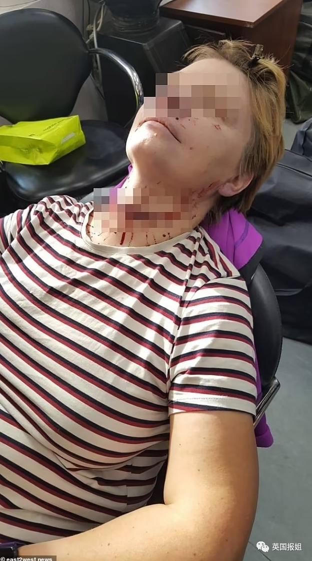 前夫雇凶杀自己，女子串通'杀手'割喉假死，反将其送进监狱休闲区蓝鸢梦想 - Www.slyday.coM