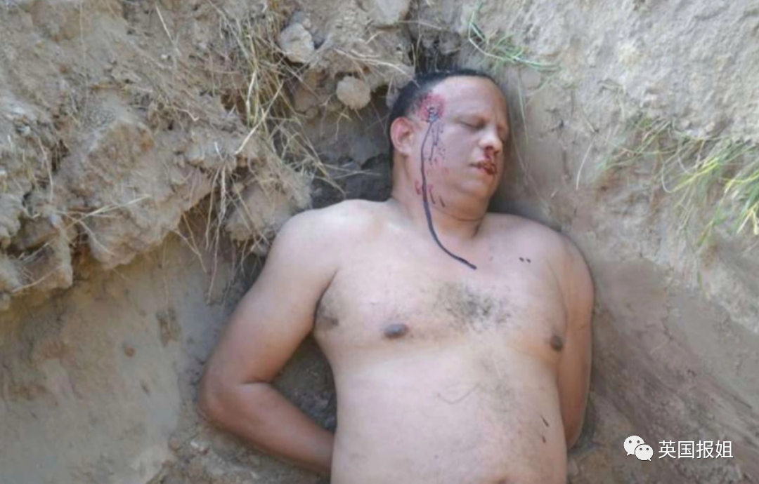 前夫雇凶杀自己，女子串通'杀手'割喉假死，反将其送进监狱休闲区蓝鸢梦想 - Www.slyday.coM