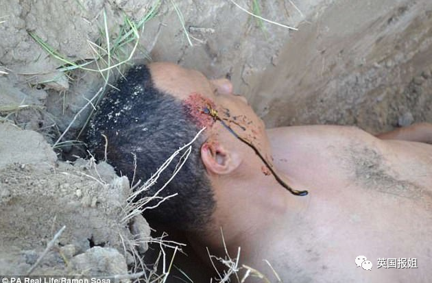 前夫雇凶杀自己，女子串通'杀手'割喉假死，反将其送进监狱休闲区蓝鸢梦想 - Www.slyday.coM