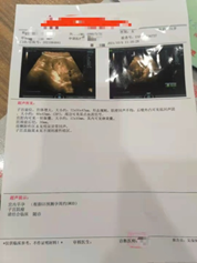 不孕不育夫妻同诊同治怀孕几率能提高多少