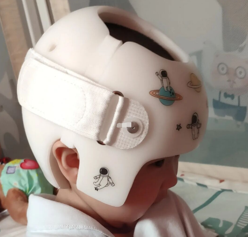 婴儿头型矫正每天戴23小时头盔请别让孩子为你的愚蠢买单好么