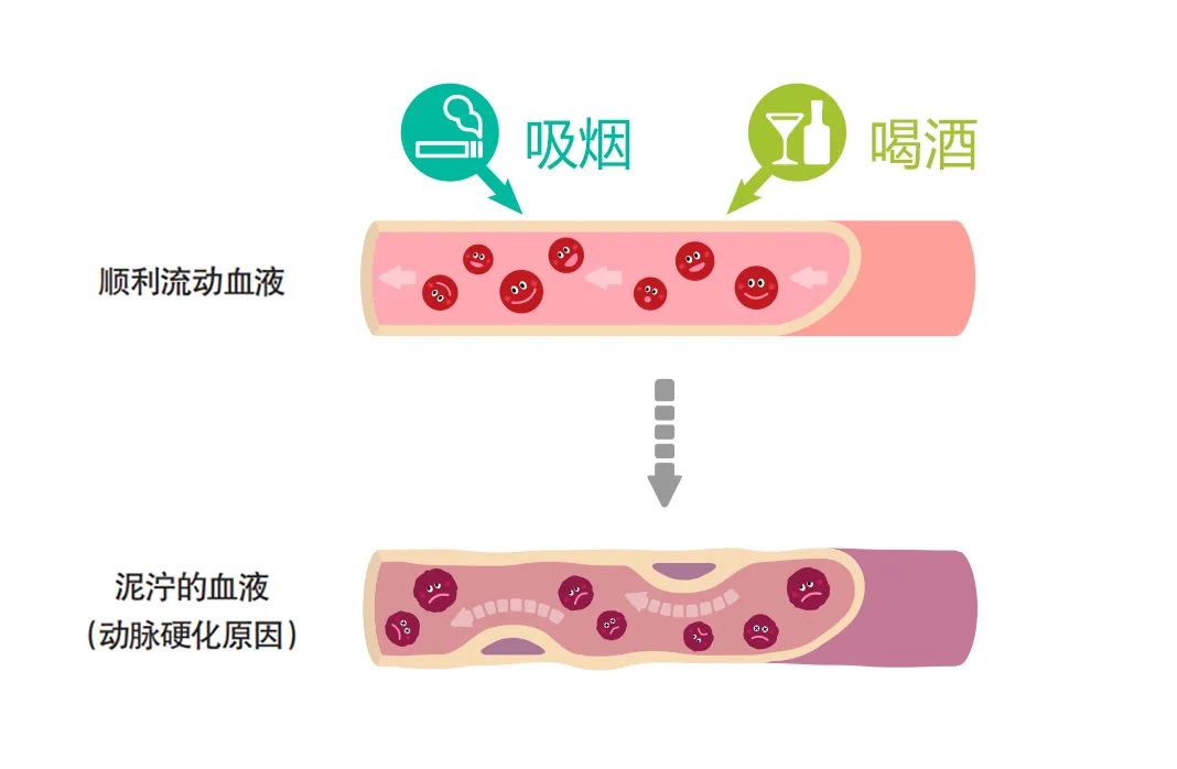 吸烟、饮酒伤血管，年轻人也无法幸免！保护血管，最好滴酒不沾，越早戒烟越好！