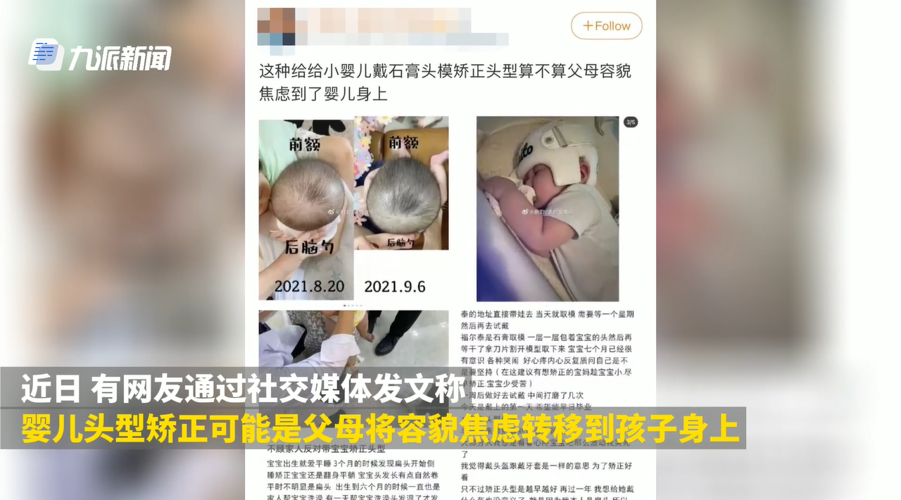 快评丨甘冒风险给婴儿戴头盔，如此育儿观更需“矫正”