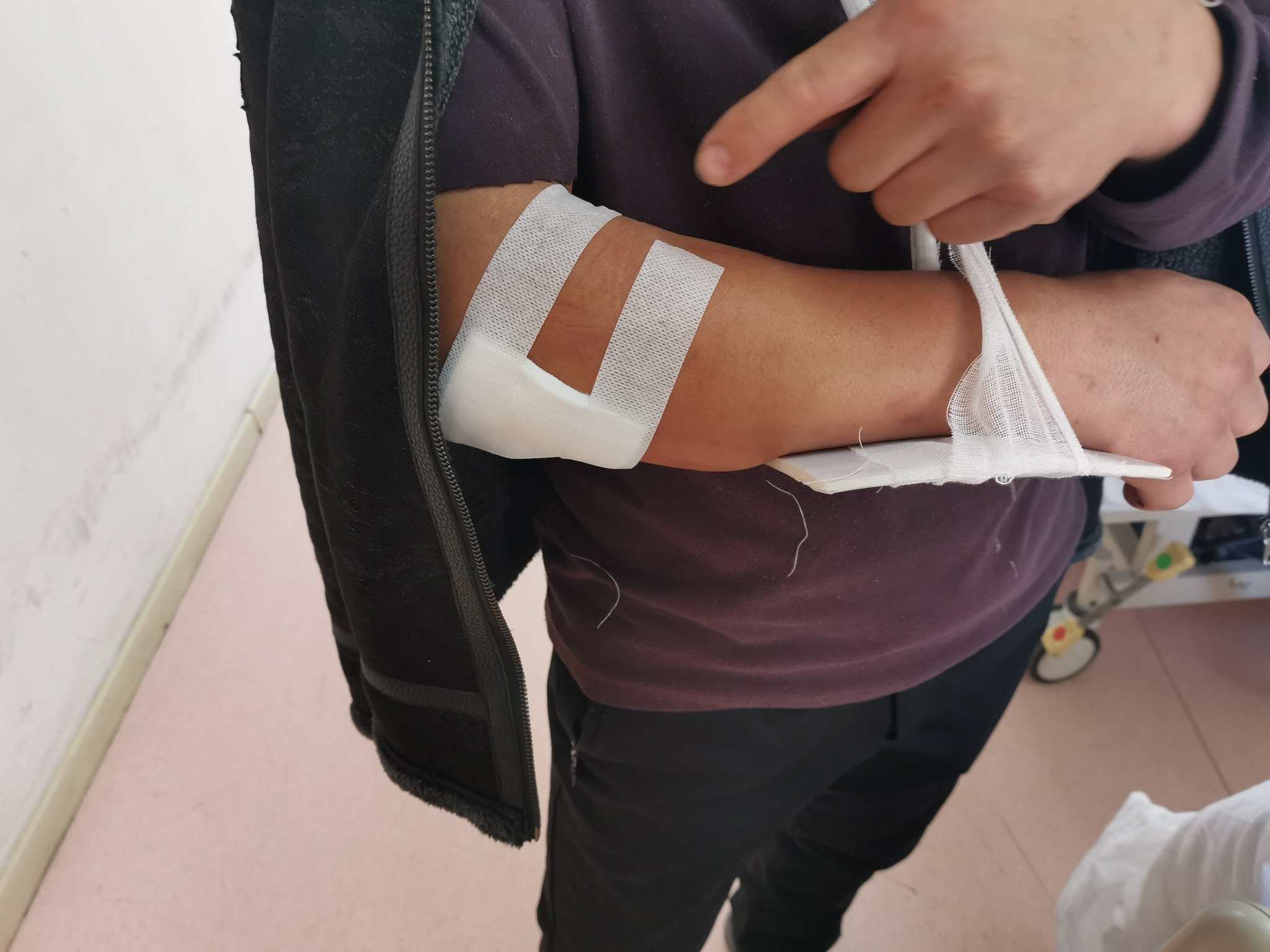 孙刚的手臂的伤口被缝了7针,至今疼痛难忍