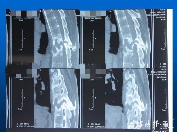 男子拎了一下桶装水，瘫痪了！这类人群要注意……休闲区蓝鸢梦想 - Www.slyday.coM