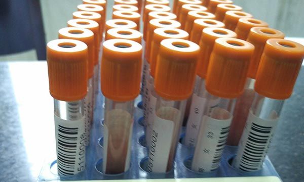 生长激素激发试验这个检查稍微有点复杂,一般会选择在上午做,并且要