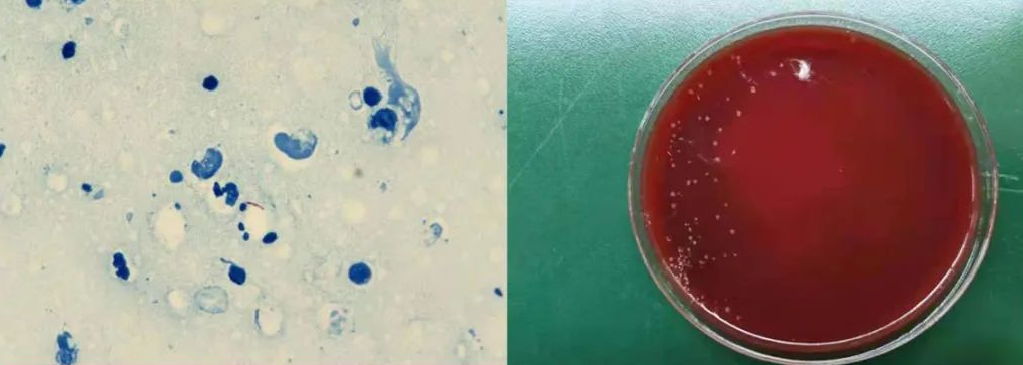 海分枝杆菌感染创口标本的抗酸染色涂片和在血平板上培养七天后的