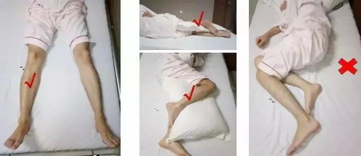 髋关节置换术后还在担心脱位骨科医生教你这样做