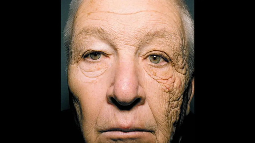 按照波长可以分为短波紫外线(uvc),中波紫外线(uvb)和长波紫外线(uva)