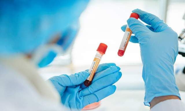 肌酐有5种骗你的方法,你“上当”了吗?休闲区蓝鸢梦想 - Www.slyday.coM