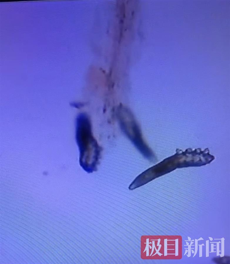 女子持续眼干眼痒，一查6根睫毛上竟有20个螨虫，竟因这个习惯导致……休闲区蓝鸢梦想 - Www.slyday.coM