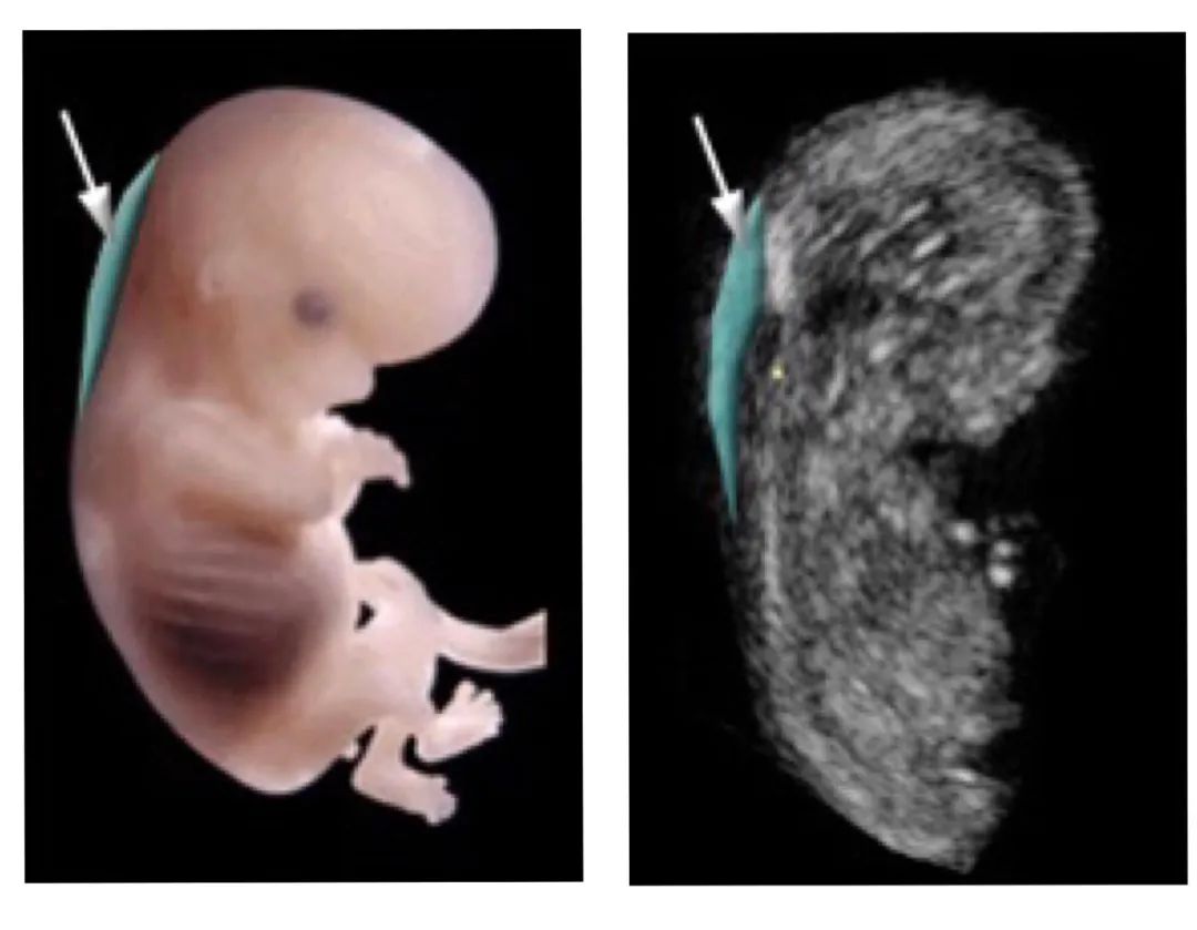 怀孕后第一次排畸检查，别错过最佳时间|准妈妈|胎儿|宝宝|畸形|染色体异常_新浪新闻