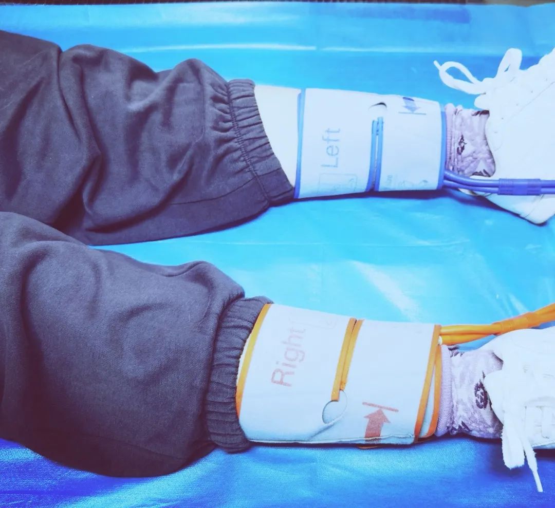 测量血压讲究多这几类患者别再忽视四肢血压测量了